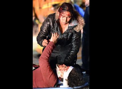 Victims of a fatal bus crash reach out to comfort each other in the wake of the crash where at least eight people were killed and nearly two dozen injured when a bus carrying a group from Tijuana, Mexico crashed with two other vehicles on its way back from Big Bear Lake on Highway 38 north of Yucaipa, Calif., Sunday, Feb. 3, 2013. Both sides of the highway remained closed two and a half hours after the crash and it was unclear when it would reopen. (AP Photo/The Sun, Rick Sforza) MANDATORY CREDIT