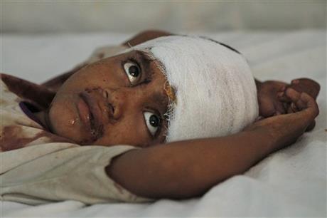 a 6-year-old girl injured in communal clashes