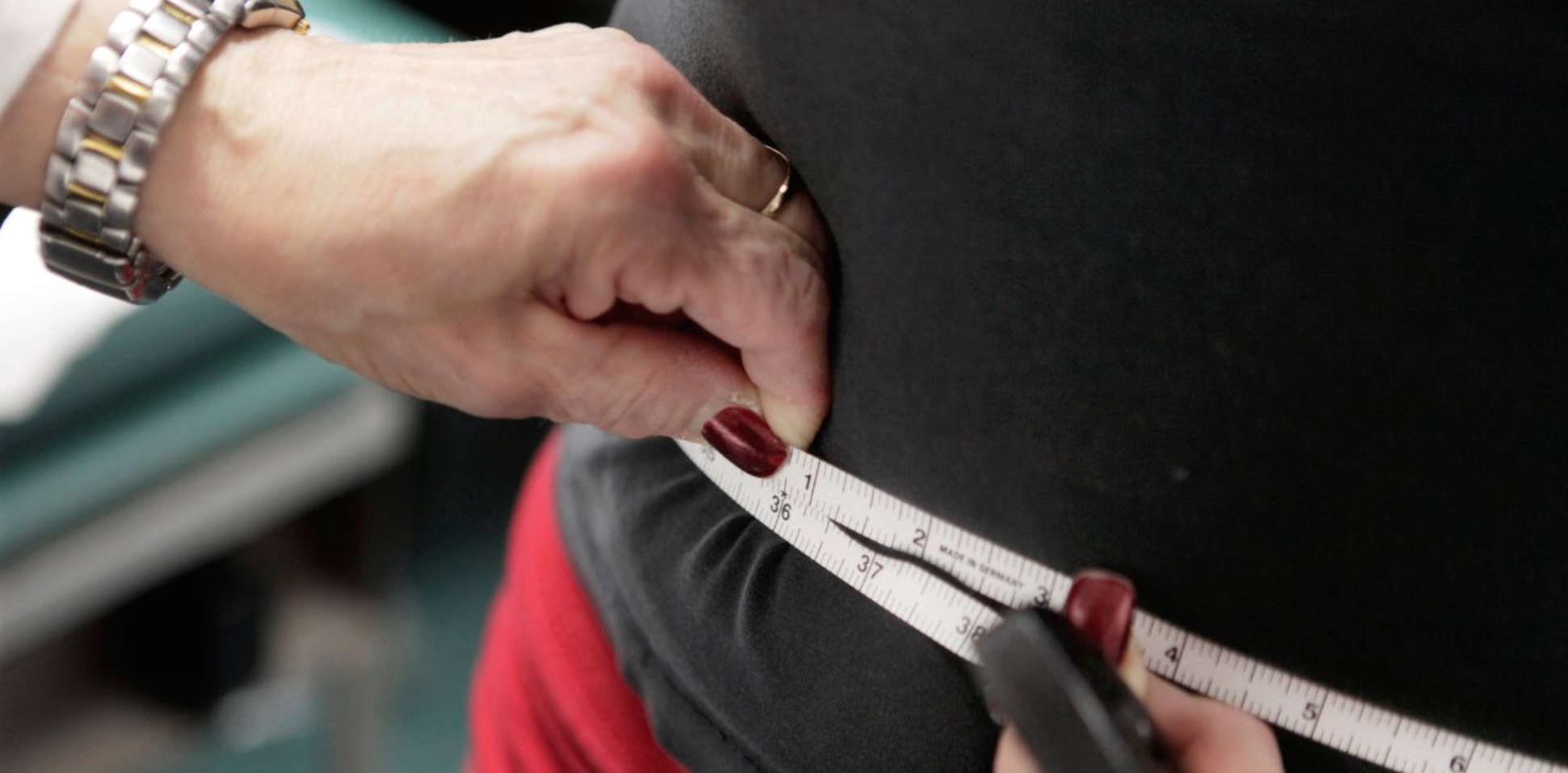 Obesity is high and holding steady in the U.S. About 4 in 10 Americans have obesity overall and about 1 in 10 have severe obesity. That’s according to new government research.