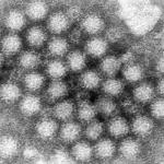 This electron microscope image provided by the Centers for Disease Control and Prevention shows a cluster of norovirus virions.