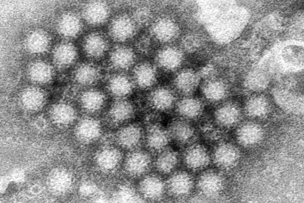 This electron microscope image provided by the Centers for Disease Control and Prevention shows a cluster of norovirus virions. 